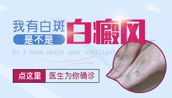 什么症状会引起白癜风